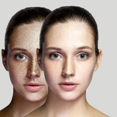 Pack premium eliminación de manchas